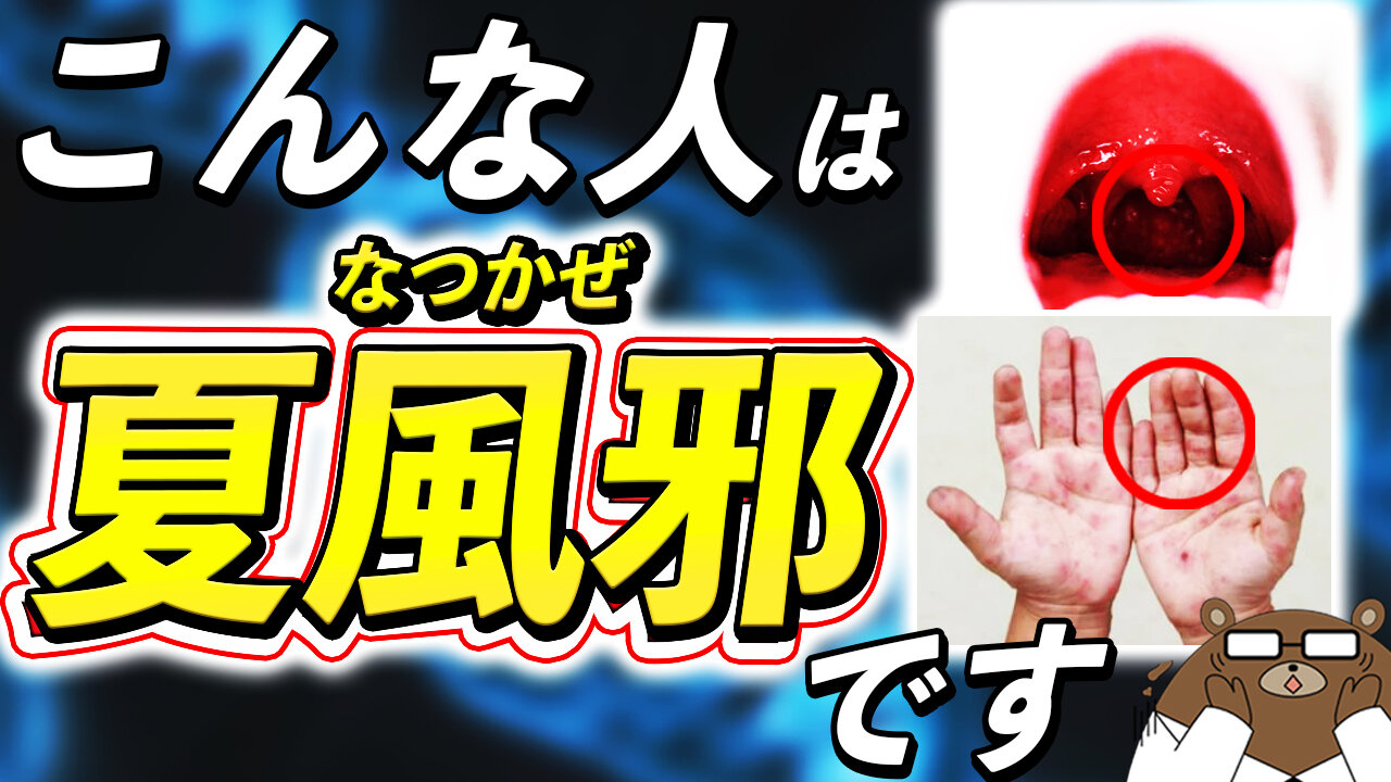 意外に知られていない「夏風邪」の特徴。どんな症状が出る？うつりやすい？医師が徹底解説